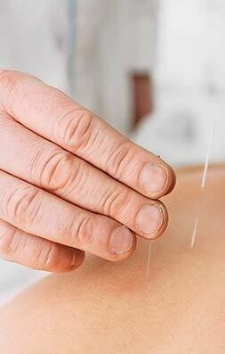 Acupuncture: Health Benefits and Side Effects